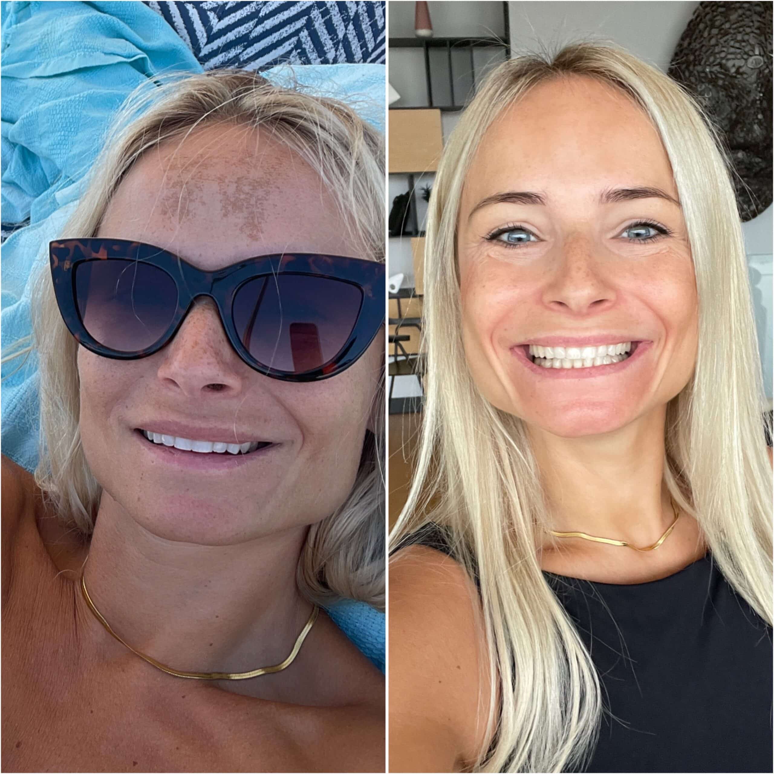 Изображение на опция за продукт